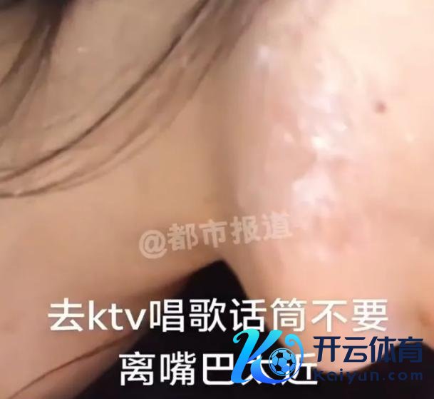 女子唱K感染病毒商家是否承担牵累 发话器卫生引包涵